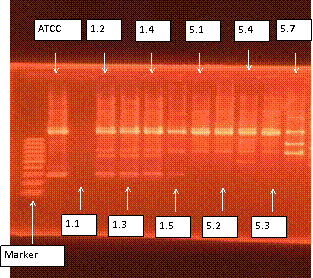 C:\Users\Win\Pictures\Fotos Feridas - Projeto\IMG_0384.JPG